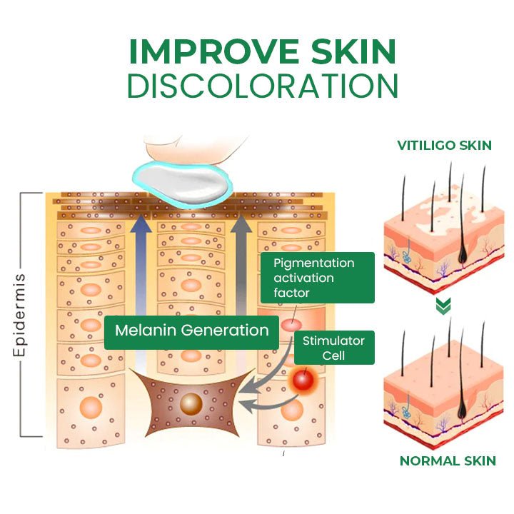 Oveallgo™ VitiligoFix Revitalize Elixir