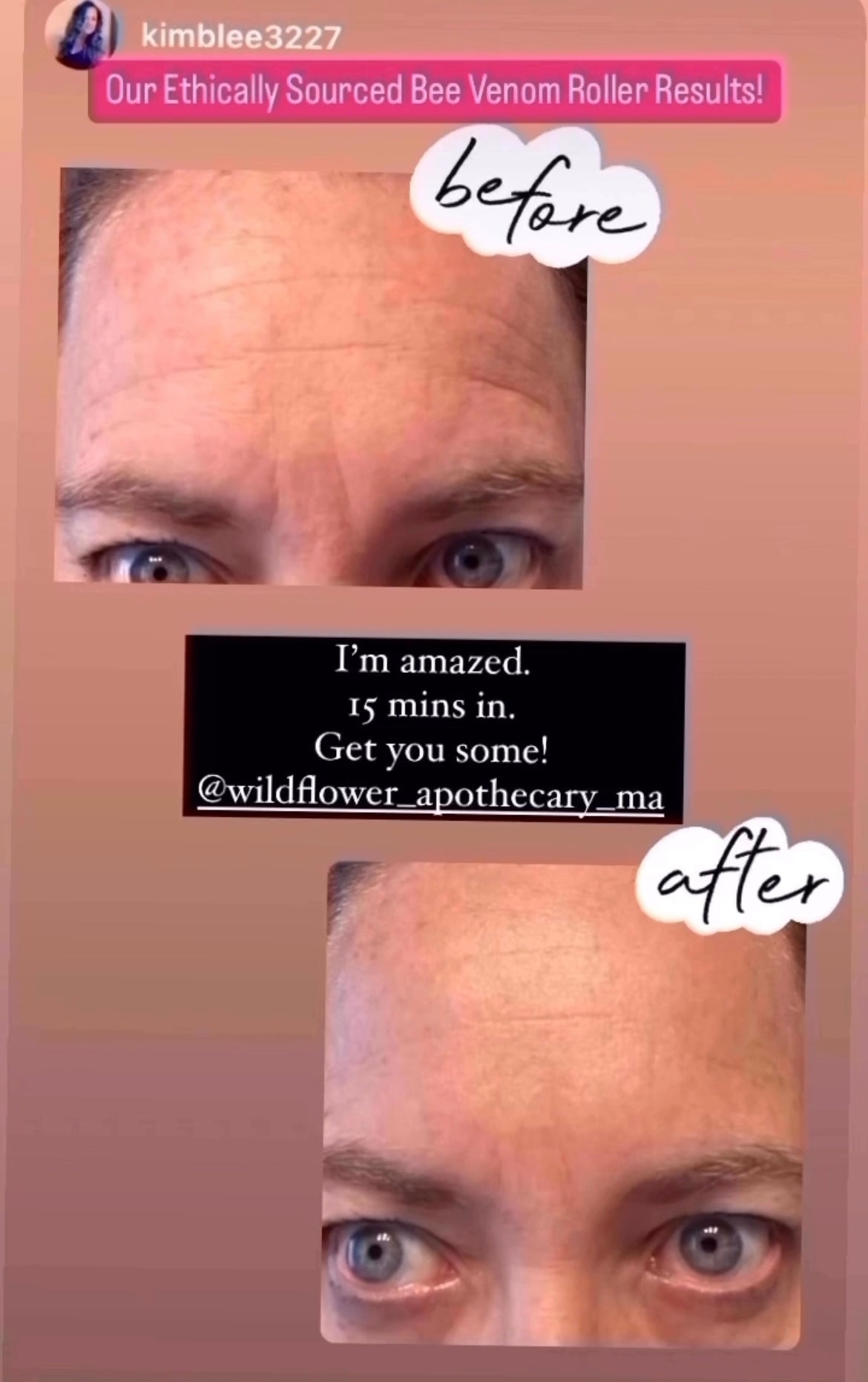 Better Than Botox Bee Venom Silk Serum