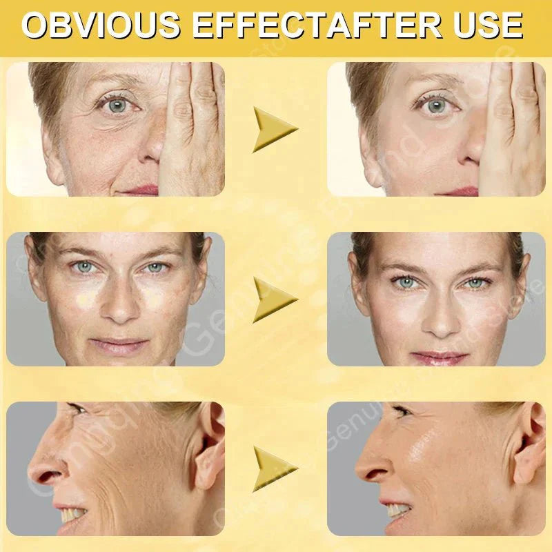 Anti Aging Remove Wrinkle Serum